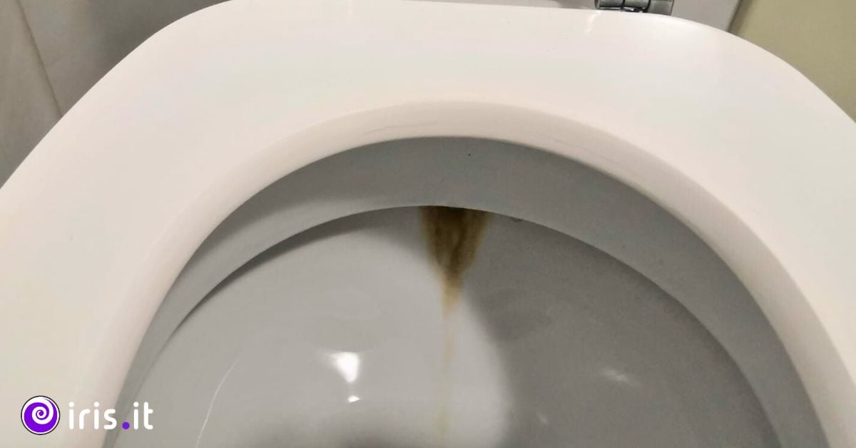 strisce calcare wc